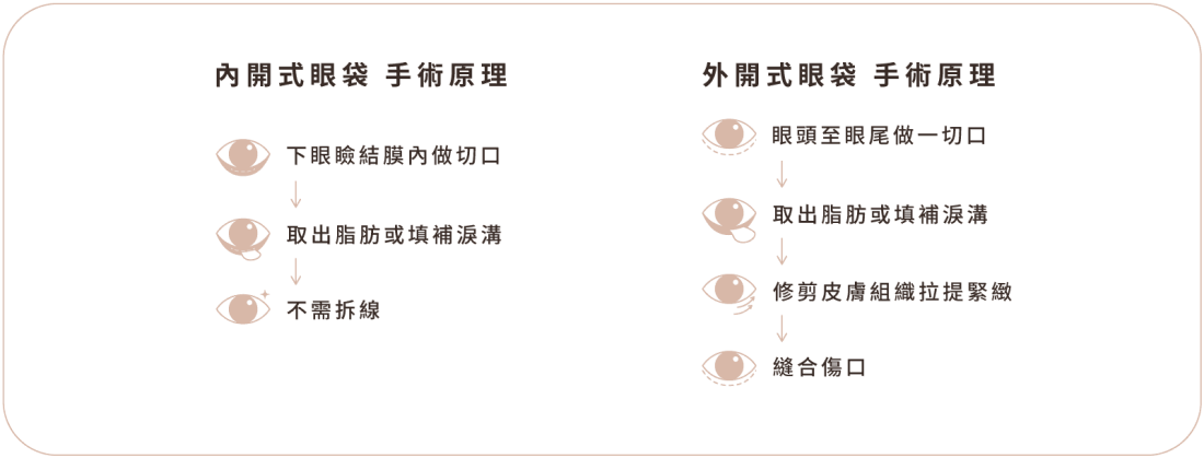 眼袋手術 手術原理