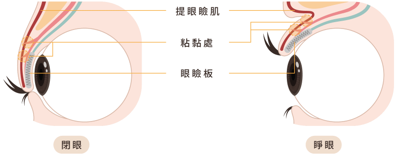 雙眼皮 小知識