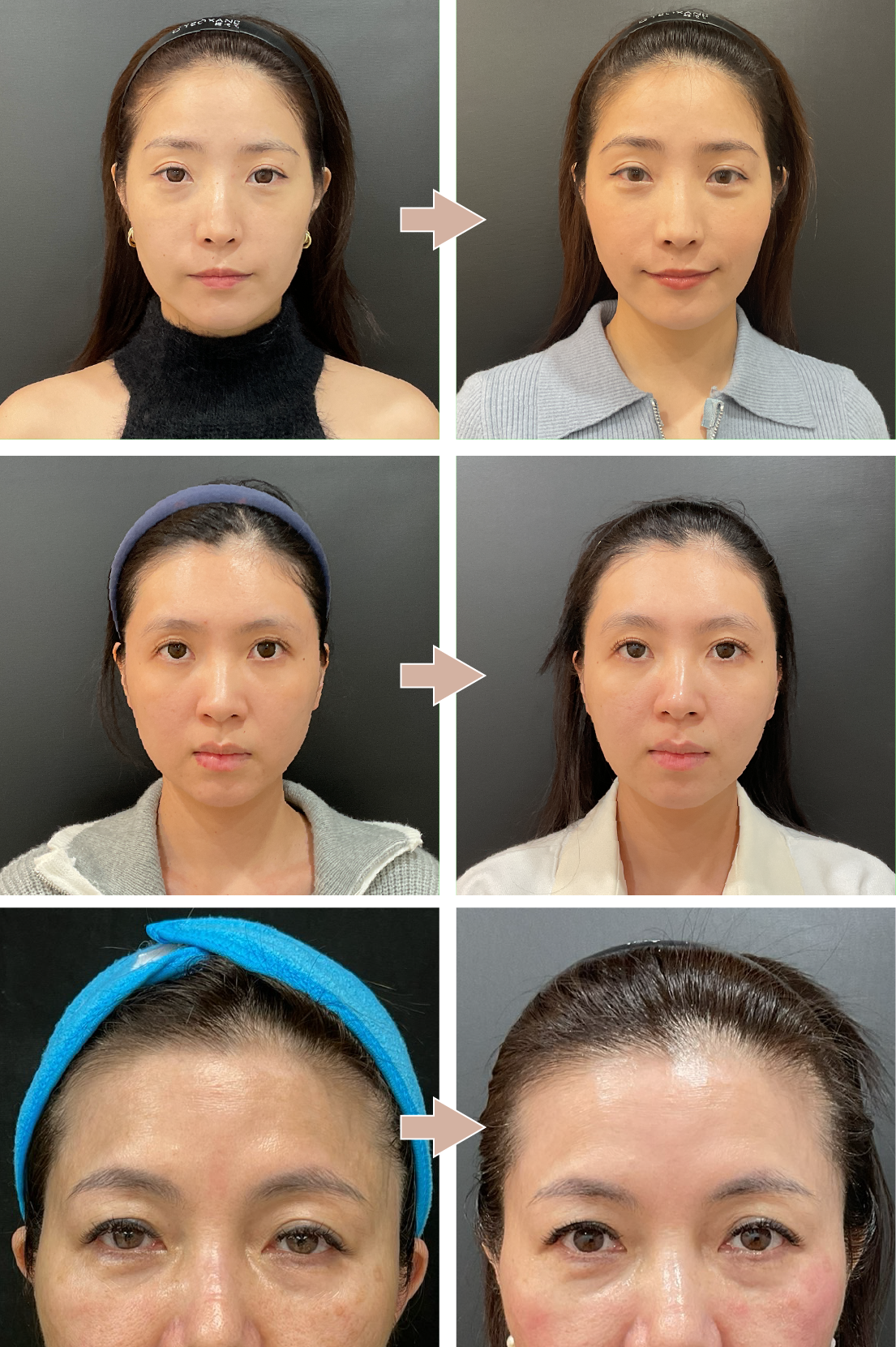 精靈美麗見證