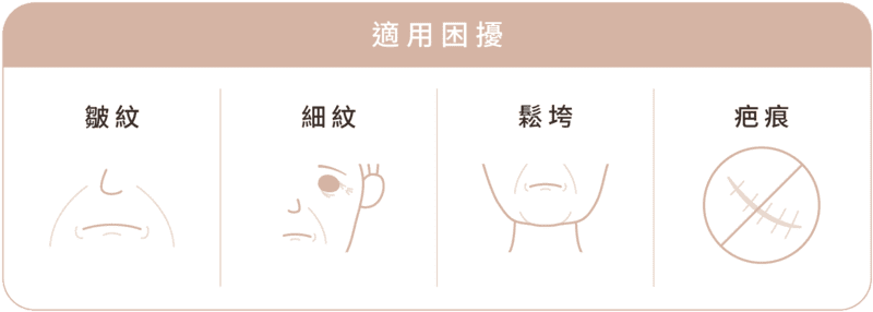 時空E電波 EXION 打包擋 痛點 適用困擾