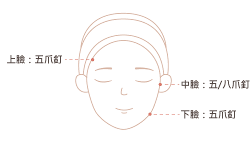 內視鏡微創拉皮手術