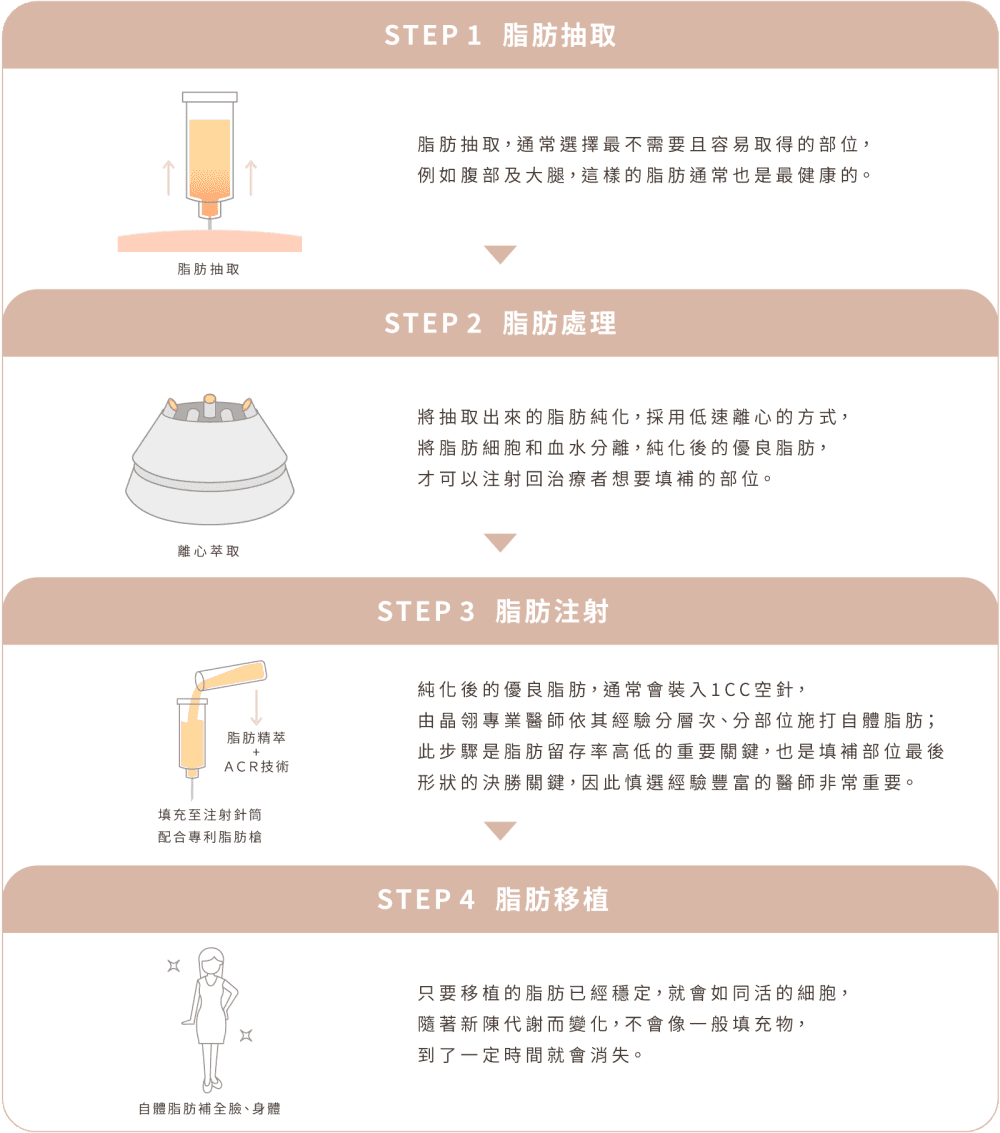 自體脂肪補臉 步驟