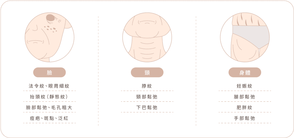 精靈電波 打包檔 適用部位