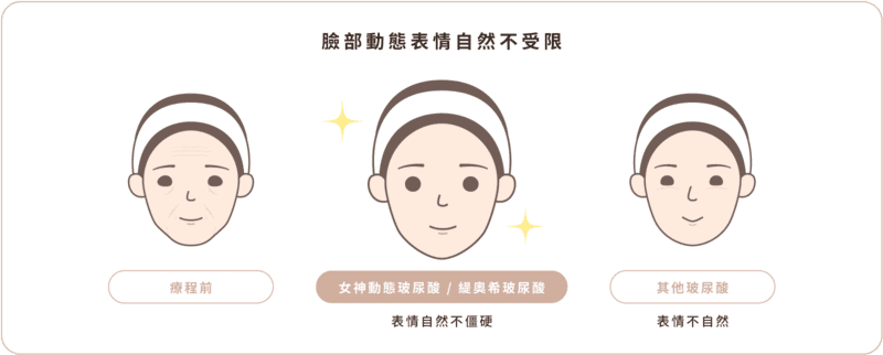 玻尿酸 小知識圖