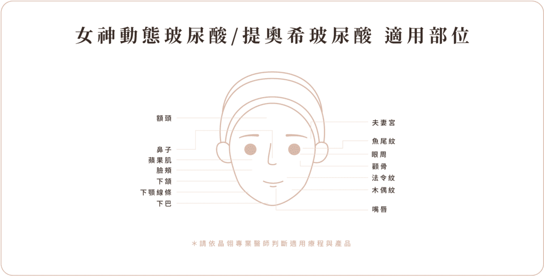 玻尿酸 適用部位