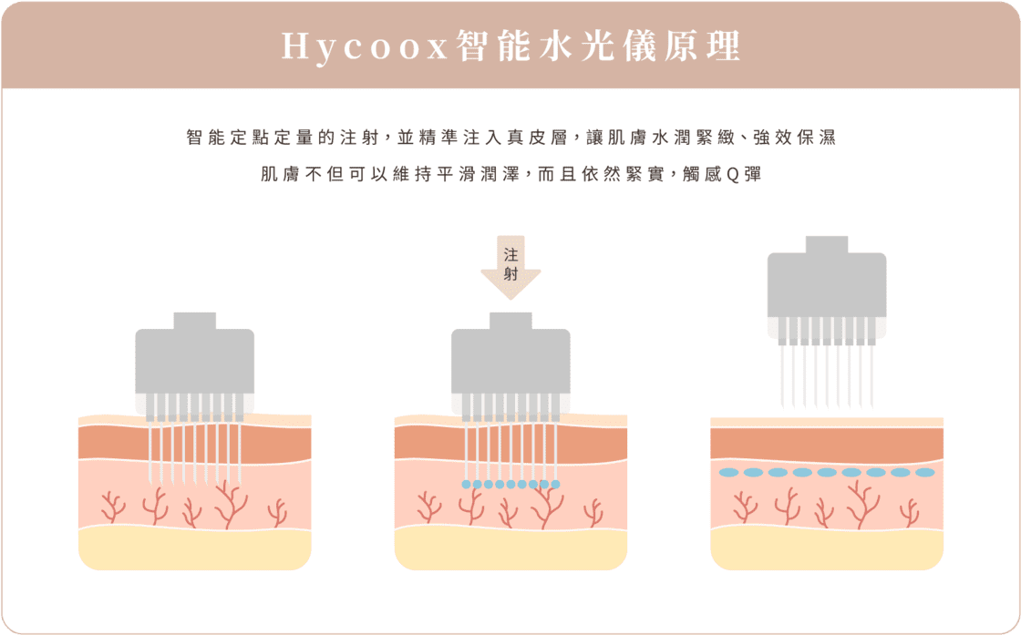 Hycoox智能水光儀 原理