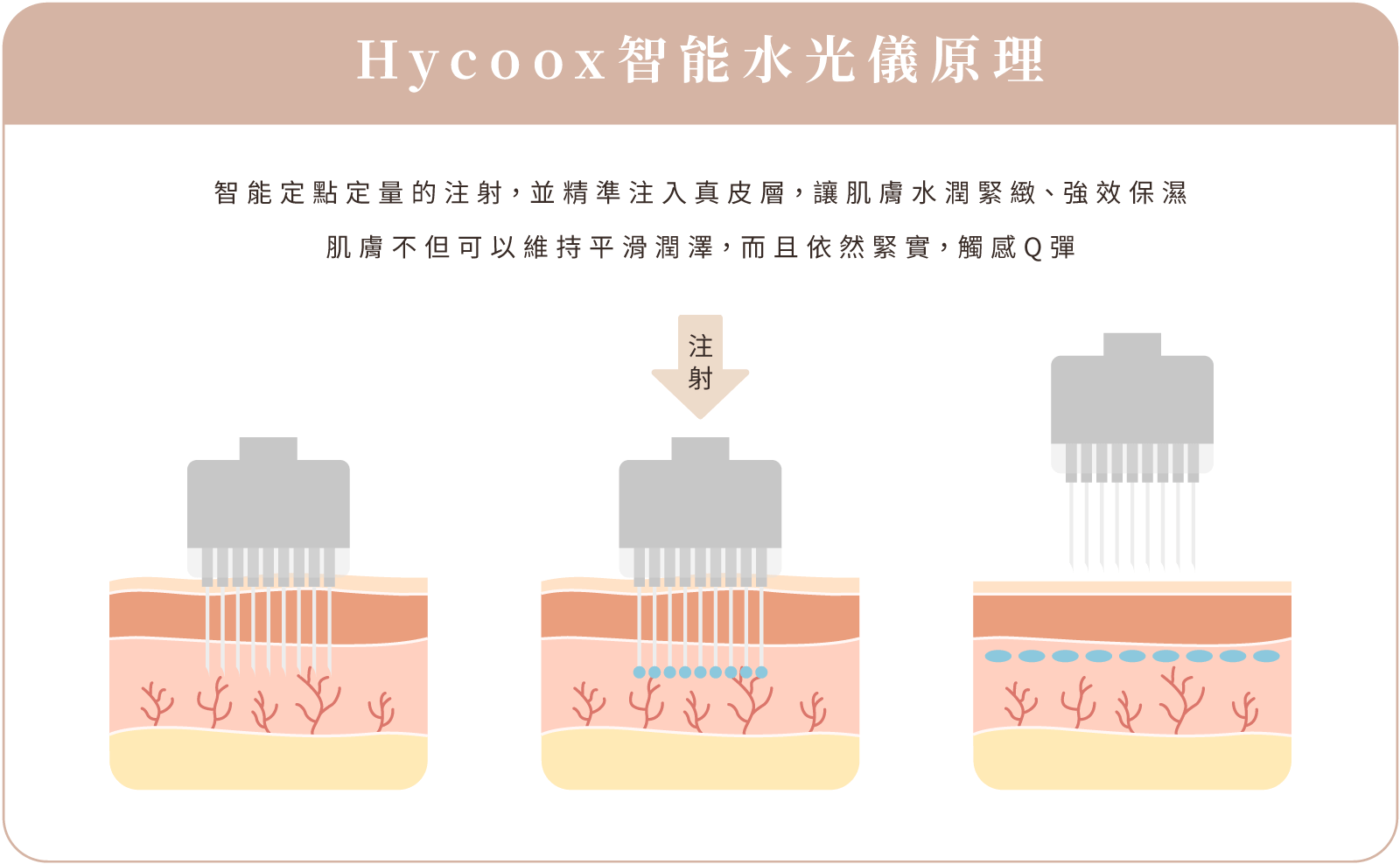 Hycoox智能水光儀 手機版 原理