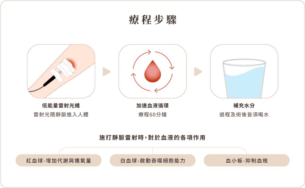 氦氖雷射 療程步驟