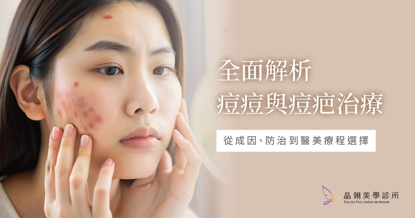 全面解析痘痘與痘疤治療:從成因、防治到醫美療程選擇_工作區域 1.jpg
