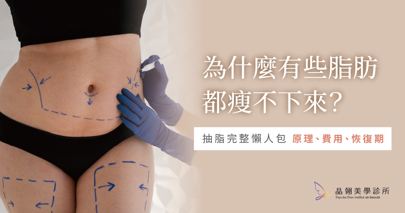 抽脂手術完整攻略:原理是什麼?適合哪些人?費用與療程怎麼選一次說清楚_工作區域 1.png