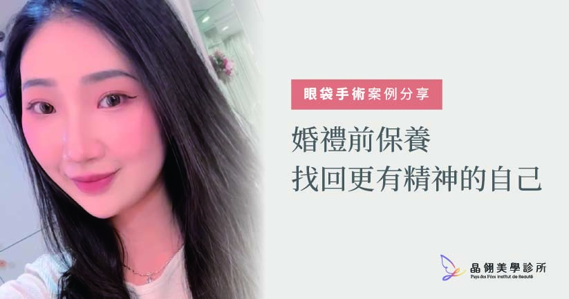 【眼袋手術案例】向無神雙眸說再見!在婚禮前,找回更有精神的自己_工作區域 1-01.jpg
