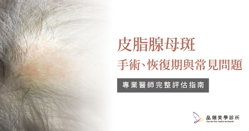 皮脂腺母斑是什麼?從成因、治療方式到手術時機完整解析.jpg