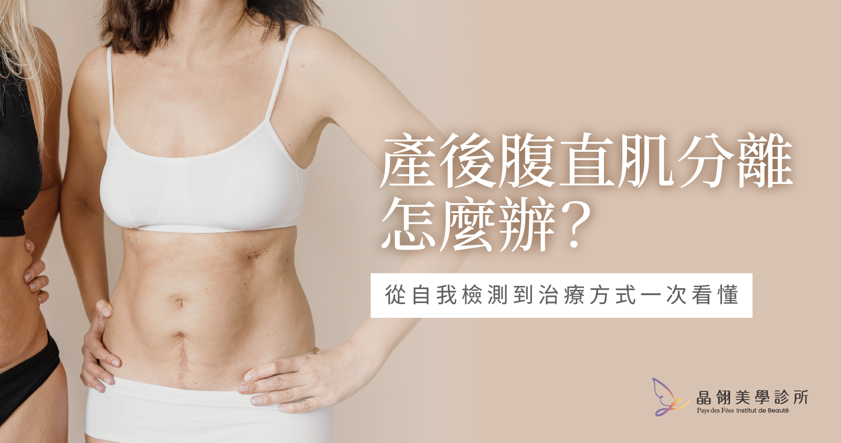【完整指南】產後腹直肌分離怎麼辦?從自我檢測到治療方式一次看懂_工作區域 1.png