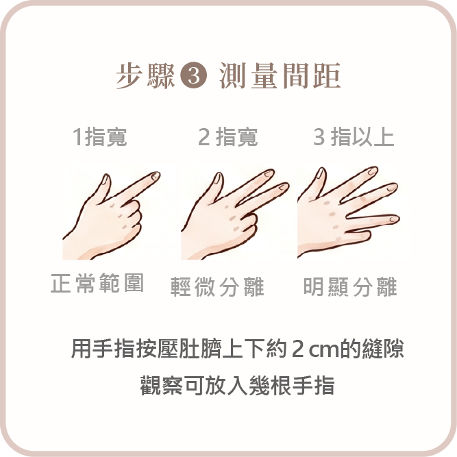 【完整指南】產後腹直肌分離怎麼辦?從自我檢測到治療方式一次看懂_工作區域 1 複本 4.png